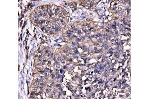 IHC analysis of Drebrin/DBN1 using anti-Drebrin/DBN1 antibody (ABIN7602638).