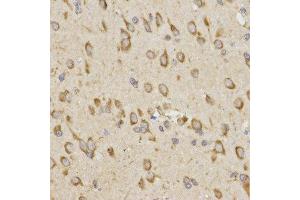 Immunohistochemistry of paraffin-embedded rat brain tissue using GRM8 antibody at dilution of 1:200 (x400 lens) (GRM8 Antikörper)