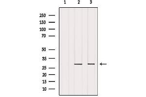 Western blot analysis of extracts from various samples, using REEP2 Antibody.