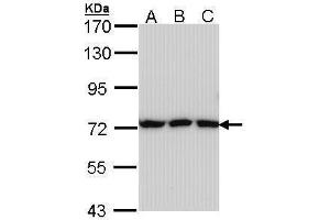 WB Image Sample (30 ug of whole cell lysate) A: A431 , B: H1299 C: Hela 7. (Transferrin Antikörper)