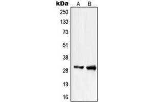 Western blot analysis of PIGX expression in COLO205 (A), WI38 (B) whole cell lysates. (PIGX Antikörper  (C-Term))