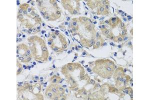 Immunohistochemistry of paraffin-embedded Human stomach using ST8SIA2 Polyclonal Antibody at dilution of 1:100 (40x lens). (ST8SIA2 Antikörper)