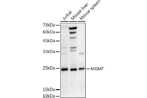 Western blot analysis of extracts of various cell lines, using MGMT antibody (ABIN3021096, ABIN3021097, ABIN3021098 and ABIN6213949) at 1:1000 dilution. (MGMT Antikörper  (AA 1-207))