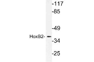 Western blot (WB) analysis of HoxB2 antibody in extracts from LOVO cells.