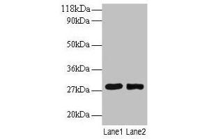 Western blot All lanes: MPZ antibody at 2 μg/mL Lane 1: 293T whole cell lysate Lane 2: EC109 whole cell lysate Secondary Goat polyclonal to rabbit IgG at 1/15000 dilution Predicted band size: 28, 35 kDa Observed band size: 28 kDa (MPZ Antikörper  (AA 30-156))