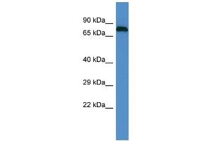 Host: Rabbit Target Name: EPN1 Sample Type: PANC1 Whole Cell lysates Antibody Dilution: 1. (Epsin 1 Antikörper  (C-Term))