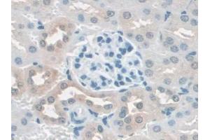 DAB staining on IHC-P; Samples: Mouse Kidney Tissue (SCAF11 Antikörper  (AA 969-1165))