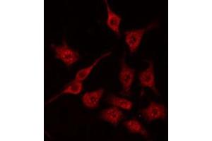 ABIN6272244 staining HeLa by IF/ICC. (ARHGAP1 Antikörper  (Internal Region))