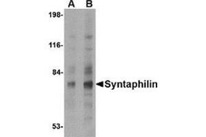Western blot analysis of Syntaphilin in human brain tissue lysate with this product at (A) 2 and (B) 4 μg/ml.