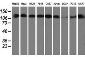 Western blot analysis of extracts (35 µg) from 9 different cell lines by using anti-HDAC6 monoclonal antibody. (HDAC6 Antikörper)