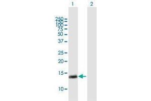 Western Blot analysis of RAB28 expression in transfected 293T cell line by RAB28 MaxPab polyclonal antibody. (RAB28 Antikörper  (AA 1-95))