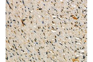 Phospho-SNAIL (Ser11) Antibody at 1/100 staining Rat heart tissue by IHC-P. (SNAIL Antikörper  (pSer11))