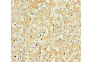 Immunohistochemistry of paraffin-embedded human liver tissue using ABIN7167868 at dilution of 1:100 (RS1 Antikörper  (AA 24-224))