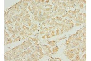 IHC analysis of paraffin-embedded human heart tissue using TNNI3K antibody (1/100 dilution).