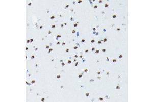 Immunohistochemistry (IHC) image for anti-Ribosomal Protein S6 Kinase, 70kDa, Polypeptide 1 (RPS6KB1) (pSer424), (pThr421) antibody (ABIN6136296)