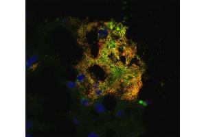 Indirect immunostaining of an acetone fixed cryo-section from an Alzheimer´s disease patient with anti Abeta 42 (dilution 1 : 100; red) and mouse anti Abeta-pE3 (, dilution 1 : 200; green).
