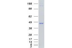 Western Blotting (WB) image for Receptor Tyrosine Kinase-Like Orphan Receptor 1 (ROR1) (Transcript Variant 2) protein (Myc-DYKDDDDK Tag) (ABIN2731083)