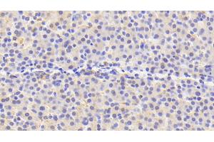 Detection of PRDX4 in Human Liver Tissue using Polyclonal Antibody to Peroxiredoxin 4 (PRDX4) (Peroxiredoxin 4 Antikörper  (AA 6-249))