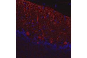 Indirect immunostaining of paraffin embedded mouse cerebellum section (dilution 1 : 200; red). (CALB1 Antikörper)