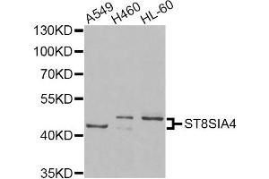 Western blot analysis of extracts of various cell lines, using ST8SIA4 Antibody (ABIN5975704) at 1/1000 dilution.