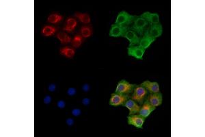 ABIN7093118 and ABIN7097808 staining Hela cells by IF/ICC. (SIGLEC15 Antikörper)