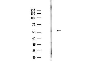 anti-Calcitonin Receptor (CALCR) (N-Term) antibody