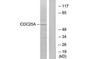 Western blot analysis of extracts from A2780 cells, treated with UV, using CDC25A (Ab-75) Antibody. (CDC25A Antikörper  (AA 43-92))
