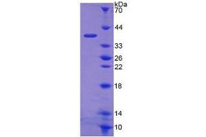 Image no. 1 for Fructosamine 3 Kinase (FN3K) (AA 1-309) protein (His tag) (ABIN4990770)