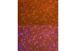 Immunofluorescence analysis of mouse brain cells using PSD93/chapsyn-110/DLG2 Rabbit mAb (ABIN7266793) at dilution of 1:100 (40x lens). (DLG2 Antikörper)