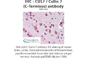 Image no. 1 for anti-Cullin 7 (CUL7) antibody (ABIN1733382)