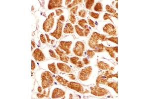 Antibody staining PCCA in human heart tissue sections by Immunohistochemistry (IHC-P - paraformaldehyde-fixed, paraffin-embedded sections). (PCCA Antikörper  (AA 362-390))