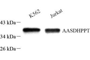 Western blot analysis of AASD-PPT (ABIN7073034) at dilution of 1: 500