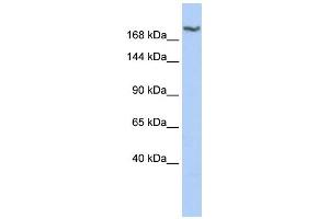 WB Suggested Anti-DSCAM Antibody Titration: 0. (DSCAM Antikörper  (Middle Region))