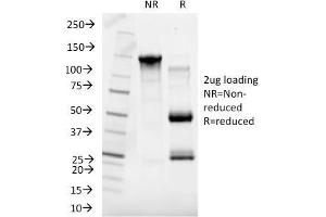 SDS-PAGE Analysis Purified SHBG Mouse Monoclonal Antibody (SHBG/245). (SHBG Antikörper)