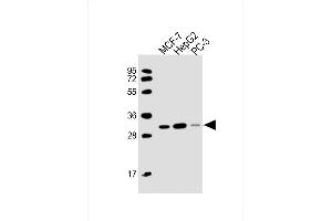 All lanes : Anti-PSME2 Antibody (Center) at 1:2000 dilution Lane 1: MCF-7 whole cell lysate Lane 2: HepG2 whole cell lysate Lane 3: PC-3 whole cell lysate Lysates/proteins at 20 μg per lane.