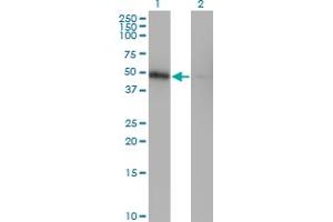Western Blot analysis of ZNF24 expression in transfected 293T cell line by ZNF24 monoclonal antibody (M03), clone 4C2. (ZNF24 Antikörper  (AA 1-368))
