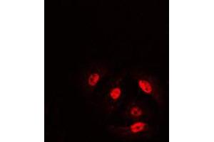 Immunofluorescent analysis of Cofilin (pS3) staining in HeLa cells. (Cofilin Antikörper  (N-Term, pSer3))