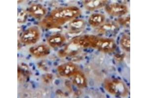 #VALUE! (PDGF-AA Homodimer (AA 87-211) Antikörper)