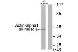 Western blot analysis of extracts from rat muscle cells, using Actin-alpha-1 Antibody. (Actin Antikörper  (AA 1-50))