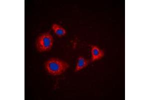 Immunofluorescent analysis of PRKAR1A staining in HT29 cells. (PRKAR1A Antikörper  (C-Term))
