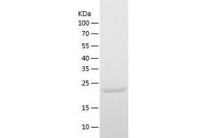 Western Blotting (WB) image for Bridging Integrator 2 (BIN2) (AA 1-244) protein (His-IF2DI Tag) (ABIN7122037)
