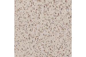 IHC analysis of U1A/SNRPA using anti-U1A/SNRPA antibody (ABIN7600891). (SNRPA1 Antikörper  (AA 25-218))