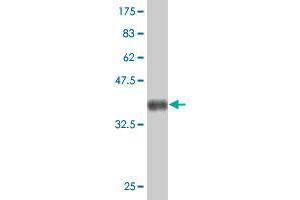 Western Blot detection against Immunogen (37. (TECTA Antikörper  (AA 1981-2080))