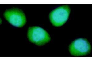 anti-DNA-Damage-Inducible Transcript 4 (DDIT4) antibody
