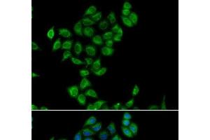 Immunofluorescence analysis of A549 cells using COQ3 Polyclonal Antibody (COQ3 Antikörper)