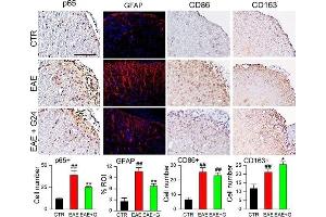 Chronic phase glibenclamide reduces inflammation and improves the macrophage phenotype in EAE. (CD163 Antikörper  (AA 1001-1121))