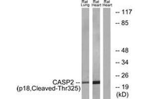 Western blot analysis of extracts from rat heart/rat lung cells, using Caspase 2 (p18,Cleaved-Thr325) Antibody.