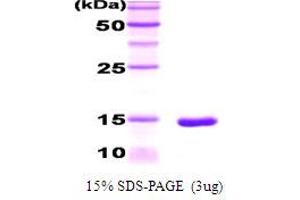 SDS-PAGE (SDS) image for CCAAT/enhancer Binding Protein (C/EBP), alpha (CEBPA) (AA 270-358) protein (His tag) (ABIN666625) (CEBPA Protein (AA 270-358) (His tag))