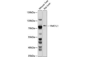 Western blot analysis of extracts of various cell lines, using YME1L1 antibody (ABIN6133153, ABIN6150333, ABIN6150334 and ABIN6214648) at 1:1000 dilution. (YME1L1 Antikörper  (AA 1-240))