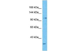 Western Blotting (WB) image for anti-Nuclear Factor of Activated T-Cells, Cytoplasmic, Calcineurin-Dependent 3 (NFATC3) (N-Term) antibody (ABIN2792685)